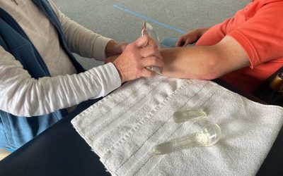 Astym® Therapy: Eliminating Scar Tissue and Chronic Pain